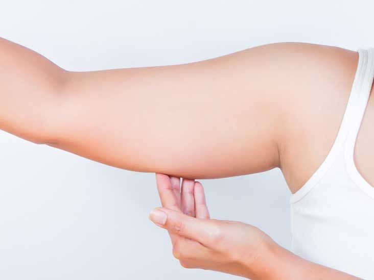 Reducción de brazo